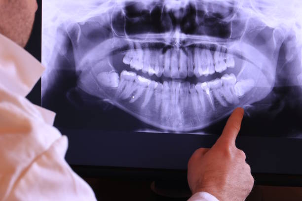 Best Emergency Broken Tooth Repair in Plano, TX