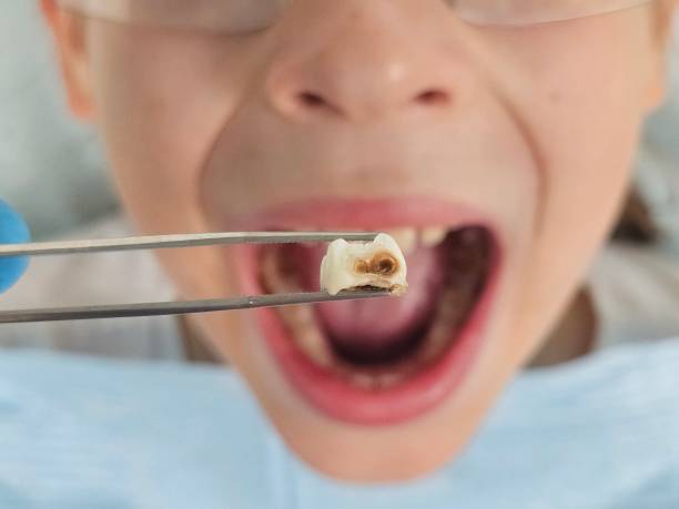 Best Walk-In Emergency Dentist in Plano, TX